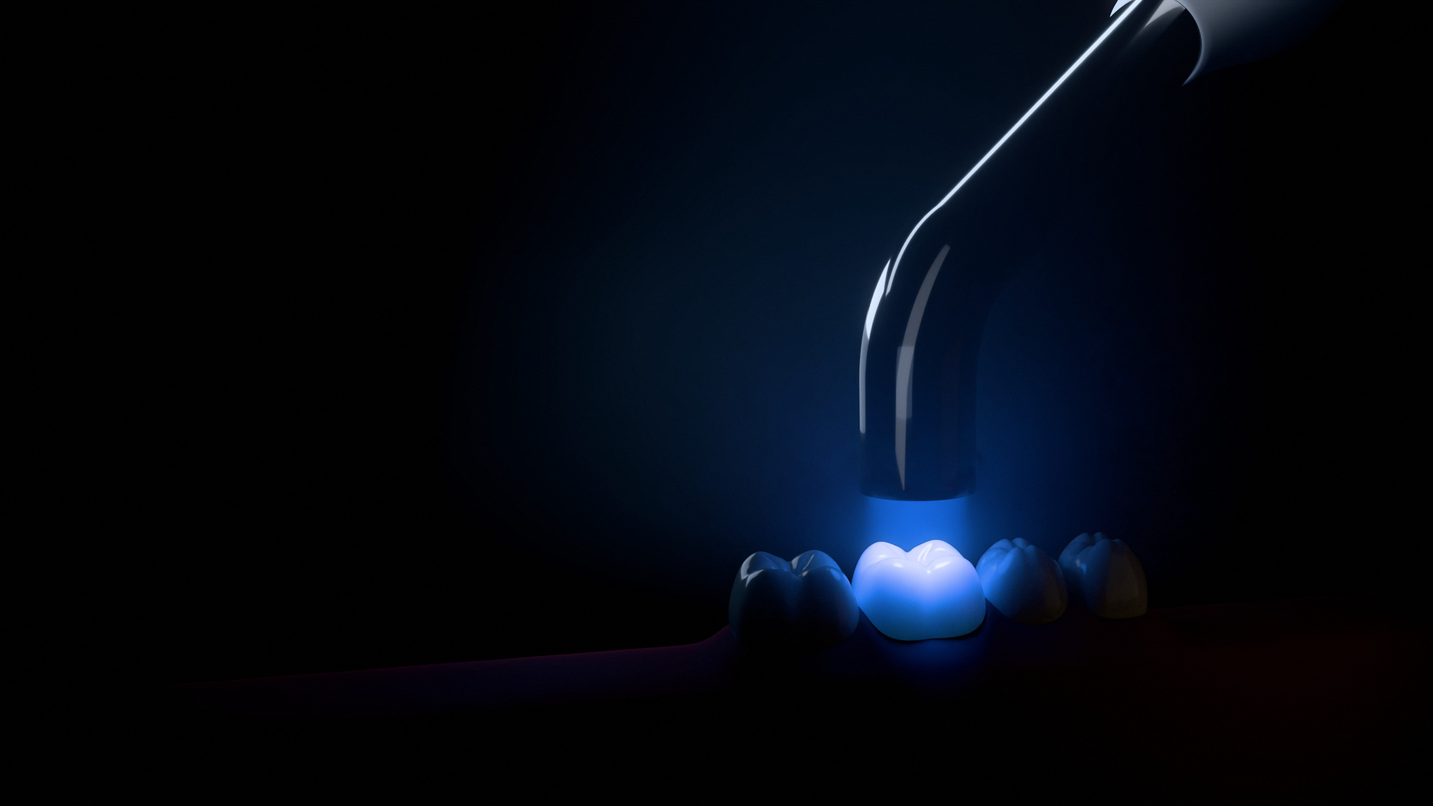 A curing light shining a blue beam onto one tooth in a row of teeth.