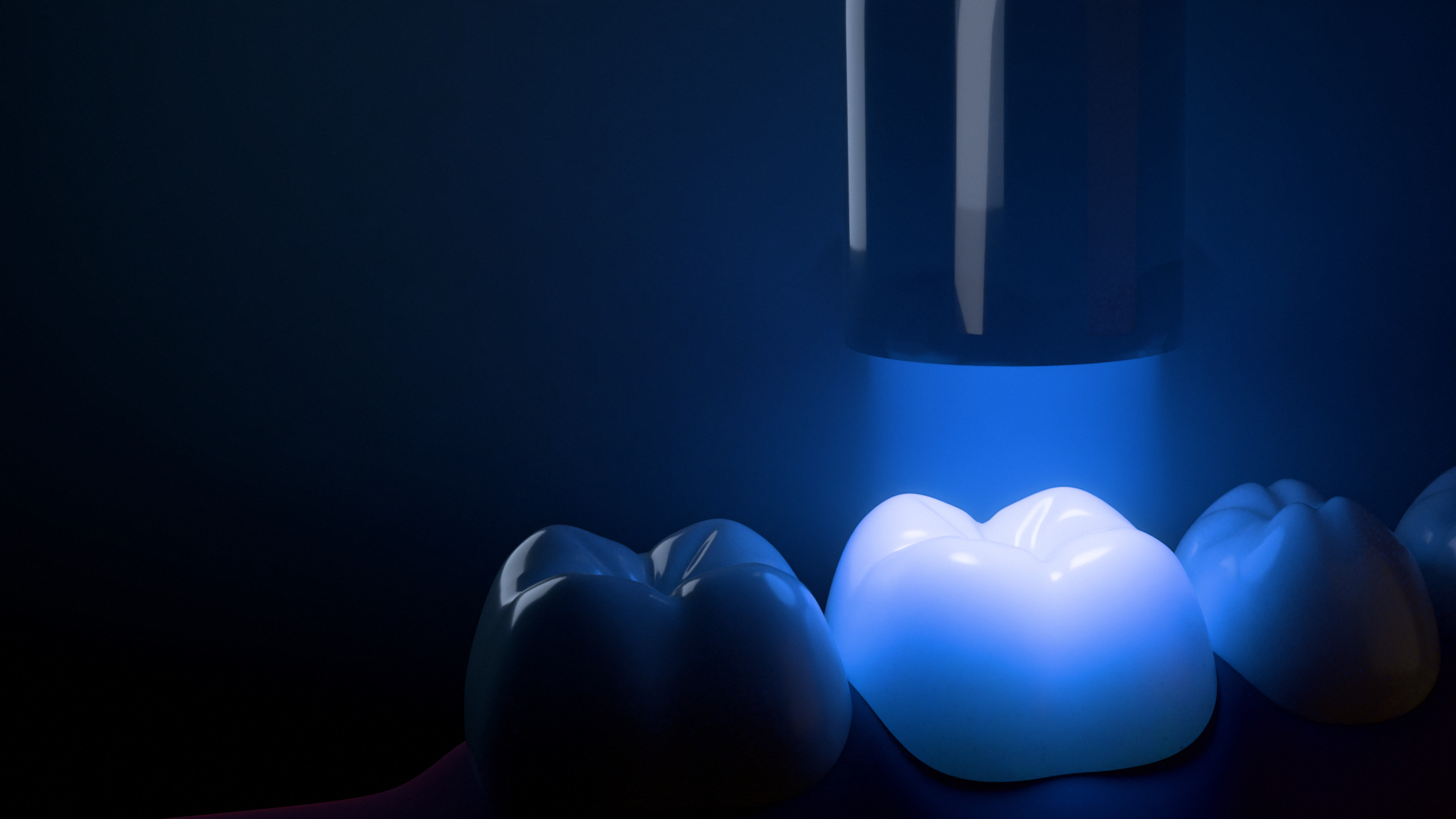 The tip of a curing light held just above a tooth, its beam on the filling.
